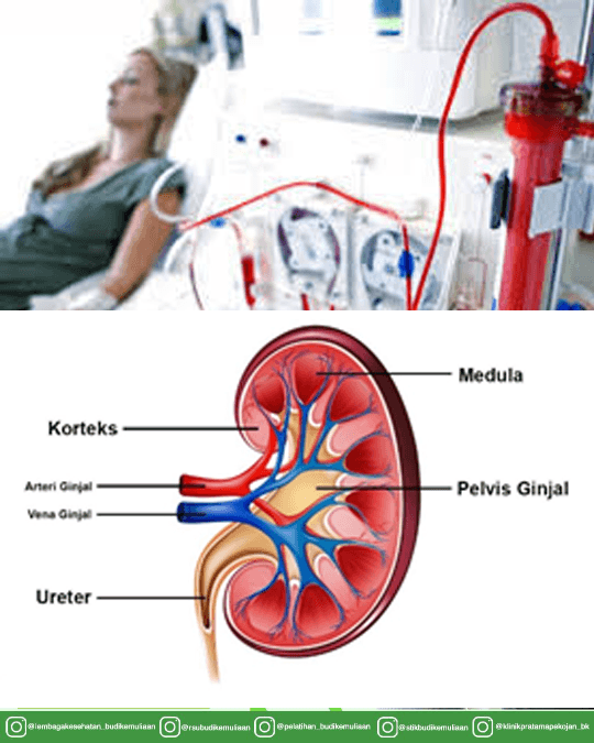 Informasi Rumah Sakit budi Kmeuliaan